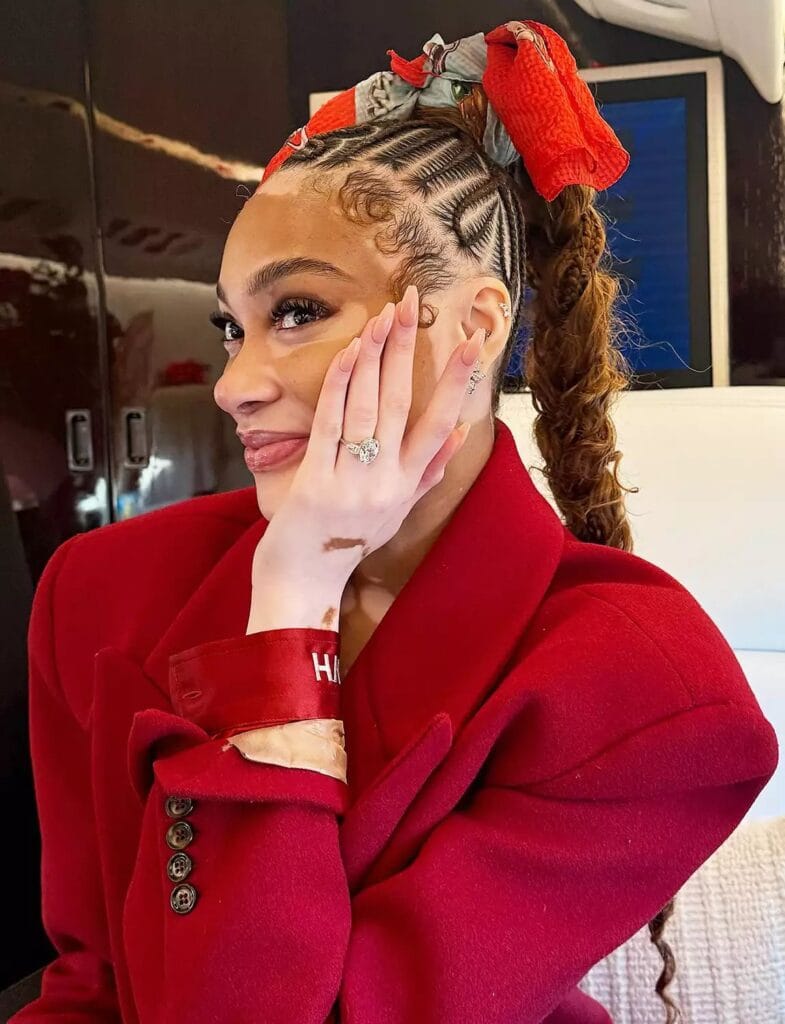 Winnie Harlow and Kyle Kuzma Are Engaged: ‘We’re Overjoyed’ 5 Winnie Harlow and Kyle Kuzma Are Engaged: ‘We’re Overjoyed’