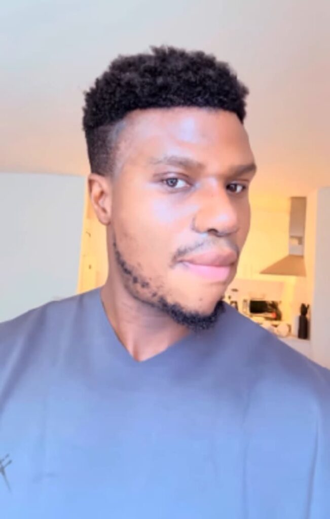 Zicsaloma Does a Full Recap and Real Reason Why He Did a Nose Surgery 4 zicsaloma12035694052509555488